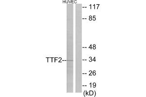 Image no. 2 for anti-Transcription Termination Factor, RNA Polymerase II (TTF2) (N-Term) antibody (ABIN1848920)