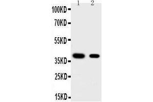 Image no. 1 for anti-Kruppel-Like Factor 5 (Intestinal) (KLF5) (AA 109-126), (Middle Region) antibody (ABIN3044106)