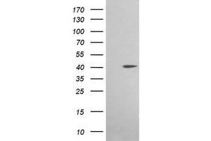 Image no. 4 for anti-Acetyl-CoA Acyltransferase 2 (ACAA2) antibody (ABIN1495723)