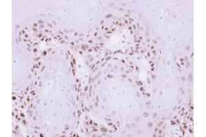 Image no. 2 for anti-Melanoma Antigen Family A, 11 (MAGEA11) (N-Term) antibody (ABIN2856757)