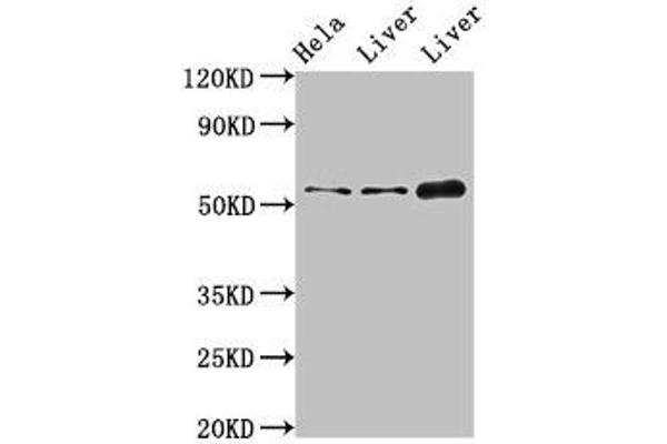 IFIT1 Antibodies