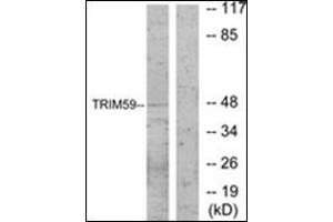 Image no. 3 for anti-Tripartite Motif Containing 59 (TRIM59) (Internal Region) antibody (ABIN1449701)