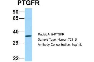 Image no. 1 for anti-Prostaglandin F Receptor (FP) (PTGFR) (C-Term) antibody (ABIN2790042)