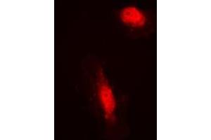 Image no. 2 for anti-COP9 Signalosome Complex Subunit 3 (COPS3) (Center) antibody (ABIN2705926)