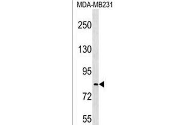LRRC70 抗体  (C-Term)