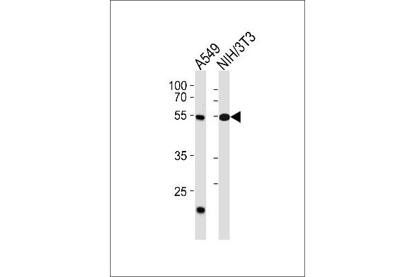 anti-T-Box 4 (TBX4) (AA 103-129), (N-Term) antibody