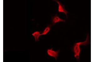Image no. 1 for anti-P53 and DNA-Damage Regulated 1 (PDRG1) antibody (ABIN6258300)