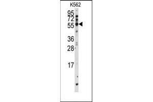 Image no. 1 for anti-Cytochrome P450, Family 2, Subfamily F, Polypeptide 1 (CYP2F1) (AA 402-432), (C-Term) antibody (ABIN360249)