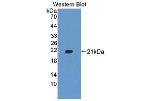 Image no. 1 for anti-Ubiquitously-Expressed, Prefoldin-Like Chaperone (UXT) (AA 15-157) antibody (ABIN5014502)