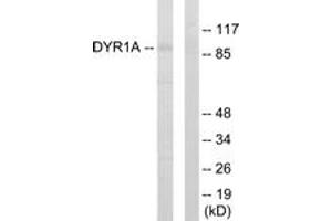 Image no. 1 for anti-Dual-Specificity tyrosine-(Y)-phosphorylation Regulated Kinase 1A (DYRK1A) (AA 21-70) antibody (ABIN1533878)