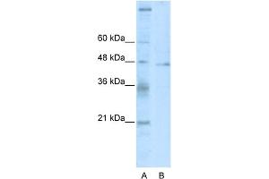 Image no. 1 for anti-Tumor Susceptibility Gene 101 (TSG101) (C-Term) antibody (ABIN2780762)