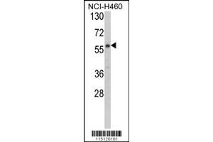 Western Blotting (WB) image for anti-Cysteinyl-tRNA Synthetase 2, Mitochondrial (Putative) (CARS2) antibody (ABIN2158043)