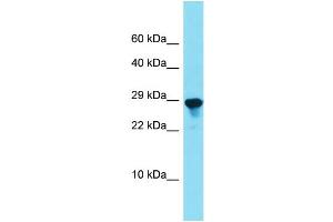 anti-Signal Peptidase Complex Subunit 2 Homolog (SPCS2) (N-Term) antibody