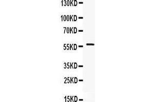 Image no. 3 for anti-IKAROS Family Zinc Finger 1 (Ikaros) (IKZF1) (AA 428-459), (C-Term) antibody (ABIN3043860)
