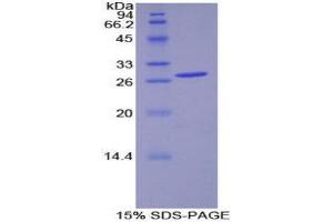 Image no. 1 for Pyruvate Dehydrogenase Kinase 1 (PDK1) (AA 233-430) protein (His tag) (ABIN1878436)
