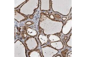 Image no. 1 for anti-Usher Syndrome 1G (Autosomal Recessive) (USH1G) antibody (ABIN5590607)