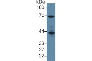 Image no. 3 for anti-Lymphocyte Cytosolic Protein 2 (SH2 Domain Containing Leukocyte Protein of 76kDa) (LCP2) (AA 202-463) antibody (ABIN1859636)