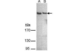 Image no. 1 for anti-Phospholipase C eta 1 (PLCh1) (Internal Region) antibody (ABIN2854598)