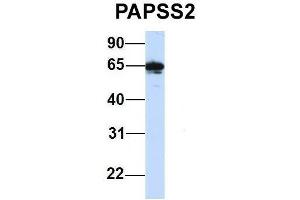 Image no. 4 for anti-3'-phosphoadenosine 5'-phosphosulfate Synthase 2 (PAPSS2) (C-Term) antibody (ABIN2783448)