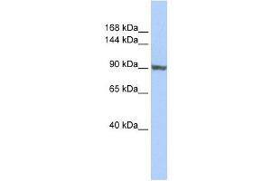 Image no. 1 for anti-TNNI3 Interacting Kinase (TNNI3K) (Middle Region) antibody (ABIN632674)