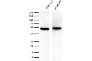 Image no. 10 for anti-Keratin 18 (KRT18) antibody (ABIN6939932)