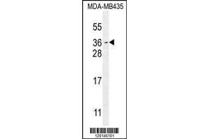 Image no. 1 for anti-Myc Target 1 (MYCT1) (AA 135-163), (C-Term) antibody (ABIN654473)