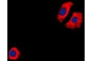 CysLTR1 anticorps