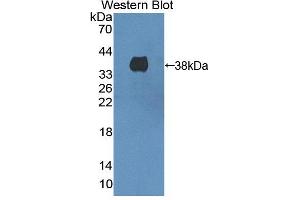 Image no. 1 for anti-3-Hydroxymethyl-3-Methylglutaryl-CoA Lyase (HMGCL) (AA 1-325) antibody (ABIN5013040)