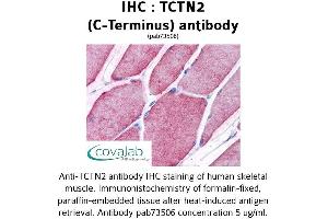 Image no. 2 for anti-Tectonic Family Member 2 (TCTN2) (C-Term) antibody (ABIN1739965)