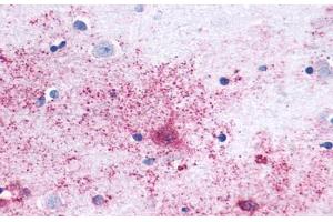 Image no. 1 for anti-MAS1 Oncogene (MAS1) (Cytoplasmic Domain) antibody (ABIN1049039)