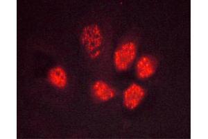 Image no. 1 for anti-Peroxisome Proliferator-Activated Receptor gamma (PPARG) (pSer112) antibody (ABIN6256109)