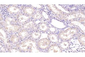 Neurotrophin 3 anticorps  (AA 130-255)