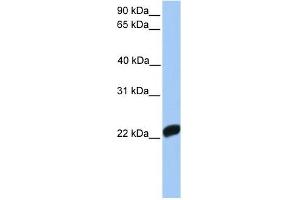 Image no. 1 for anti-Coagulation Factor X (F10) (C-Term) antibody (ABIN636058)