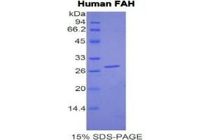Image no. 5 for Fumarylacetoacetate Hydrolase (Fumarylacetoacetase) (FAH) ELISA Kit (ABIN6574328)