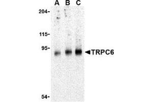 Image no. 2 for anti-Transient Receptor Potential Cation Channel, Subfamily C, Member 6 (TRPC6) (C-Term) antibody (ABIN501064)