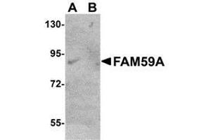 anti-Family with Sequence Similarity 59, Member A (FAM59A) (C-Term) antibody