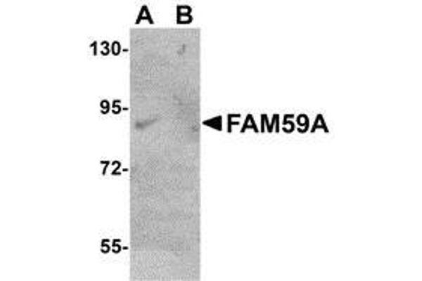 anti-Family with Sequence Similarity 59, Member A (FAM59A) (C-Term) antibody