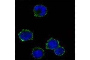 Image no. 2 for anti-CD247 Molecule (CD247) antibody (ABIN1724734)