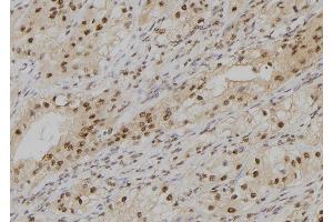 ABIN6279360 at 1/100 staining Human kidney tissue by IHC-P.