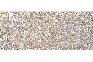 Immunohistochemistry of paraffin-embedded Human tonsil tissue using GPD1L Polyclonal Antibody at dilution of 1:60(x200)