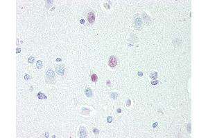 Image no. 3 for anti-Transcription Elongation Factor A (SII)-Like 3 (TCEAL3) (AA 15-43) antibody (ABIN1804789)