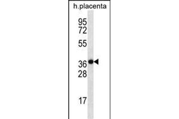 SLC38A8 antibody  (AA 149-177)