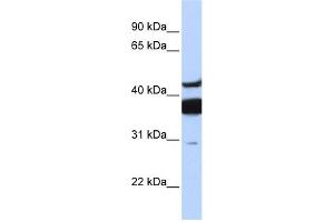 Image no. 2 for anti-Ceramide Synthase 2 (CERS2) (N-Term) antibody (ABIN2779748)
