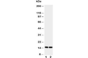 Image no. 4 for anti-Fatty Acid Binding Protein 5 (Psoriasis-Associated) (FABP5) (AA 10-23) antibody (ABIN3030914)