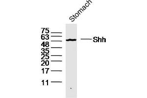 Image no. 6 for anti-Sonic Hedgehog (SHH) (AA 21-120) antibody (ABIN731108)