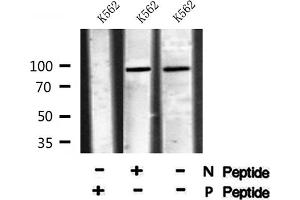 Image no. 4 for anti-Transforming Growth Factor, beta Receptor III (TGFBR3) (pThr842) antibody (ABIN6271328)