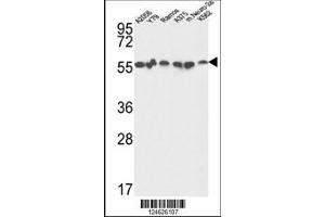 Image no. 2 for anti-Glucose-6-Phosphate Isomerase (GPI) (AA 445-473), (C-Term) antibody (ABIN653743)