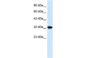 Image no. 1 for anti-Zinc Finger and BTB Domain Containing 32 (ZBTB32) (N-Term) antibody (ABIN927339)