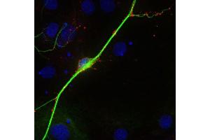 Indirect immunostaining of PFA fixed rat hippocampus neurons with anti-synaptoporin (1 : 500; red) and mouse anti-MAP 2 (cat.