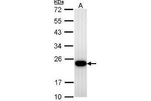 Image no. 1 for anti-Transgelin (TAGLN) (Center) antibody (ABIN2855103)